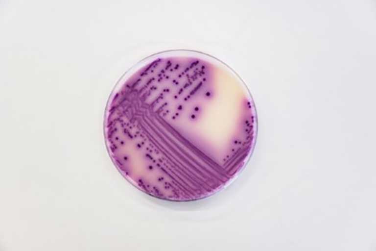 LABORATOR ANALIZE MICROBIOLOGICE